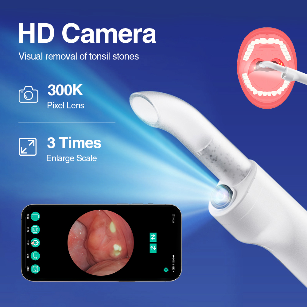 Kit Penghilang Batu Tonsil Cer - Lighting Visual ulasan dan harga